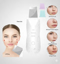 Espátula Facial Ultrasónica Exfoliante